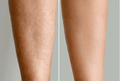 Detailed before and after comparison of legs showing visible stubble versus the smooth skin achieved with Vevor IPL hair removal treatment