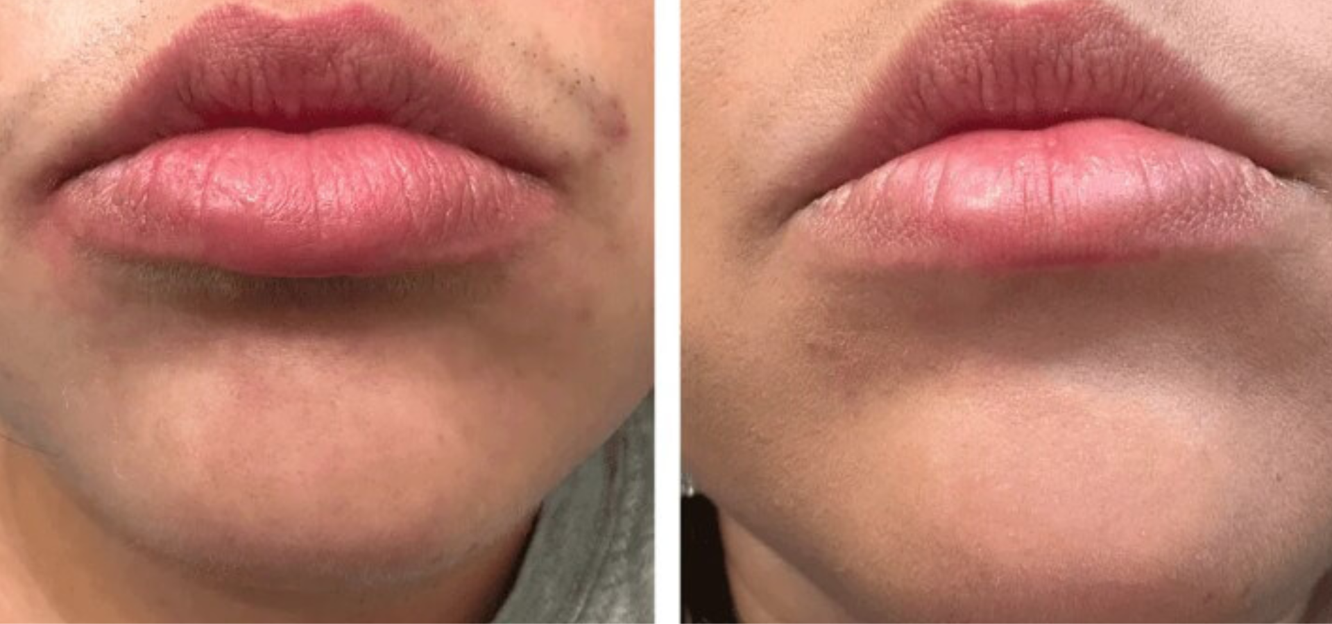 slider image slider_item_ifc6d3