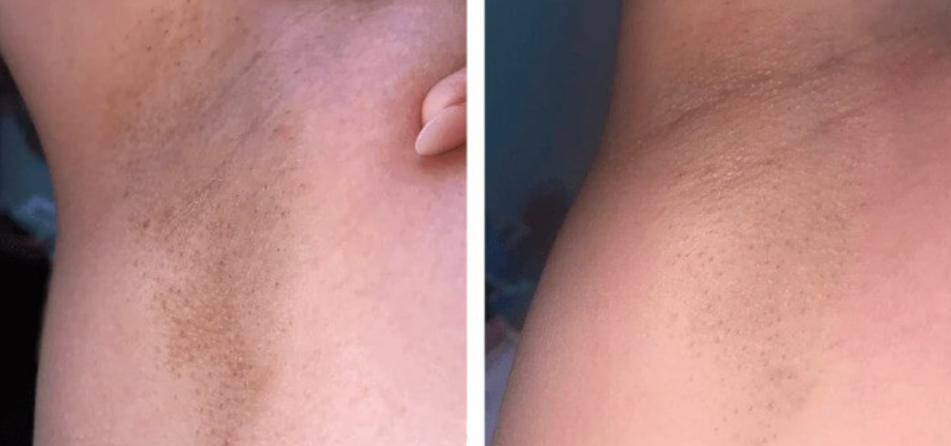 slider image slider_item_qdNt3h