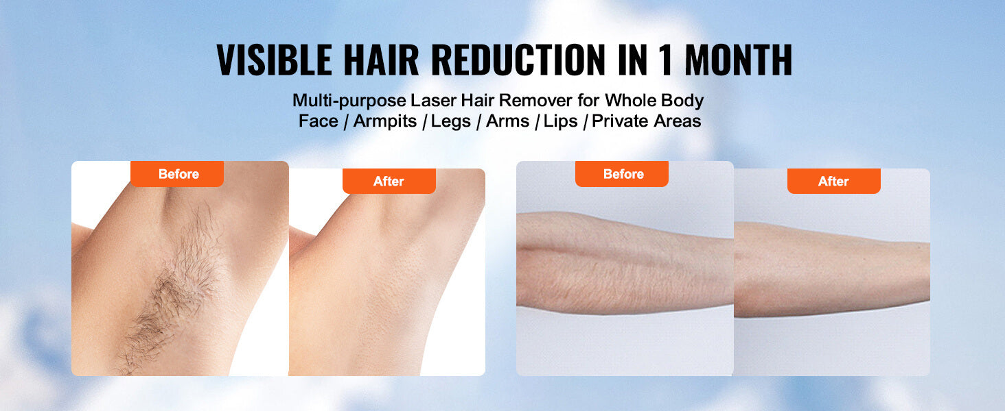 Vevor Multi-purpose IPL Laser Hair Remover ad demonstrating 'Before and After' results on the armpit and forearm, promising visible hair reduction in 1 month