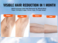 Vevor IPL Laser Hair Remover ad showing armpit and arm 'Before and After' photos, promising Visible Hair Reduction in 1 Month for whole body treatment