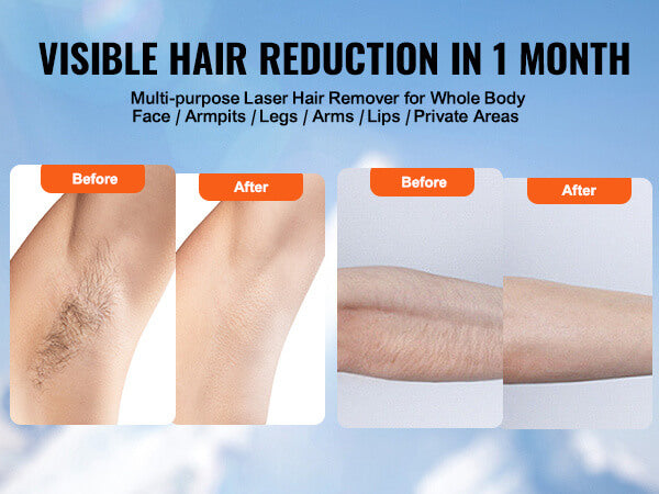 Vevor IPL Laser Hair Remover ad showing armpit and arm 'Before and After' photos, promising Visible Hair Reduction in 1 Month for whole body treatment